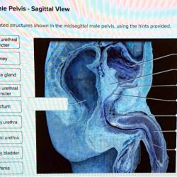 Label the midsagittal male pelvis using the hints provided