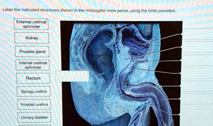 Label the midsagittal male pelvis using the hints provided