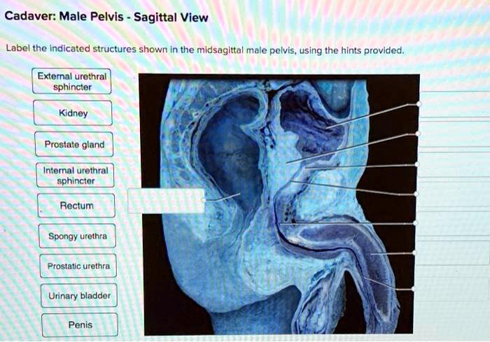 Label the midsagittal male pelvis using the hints provided