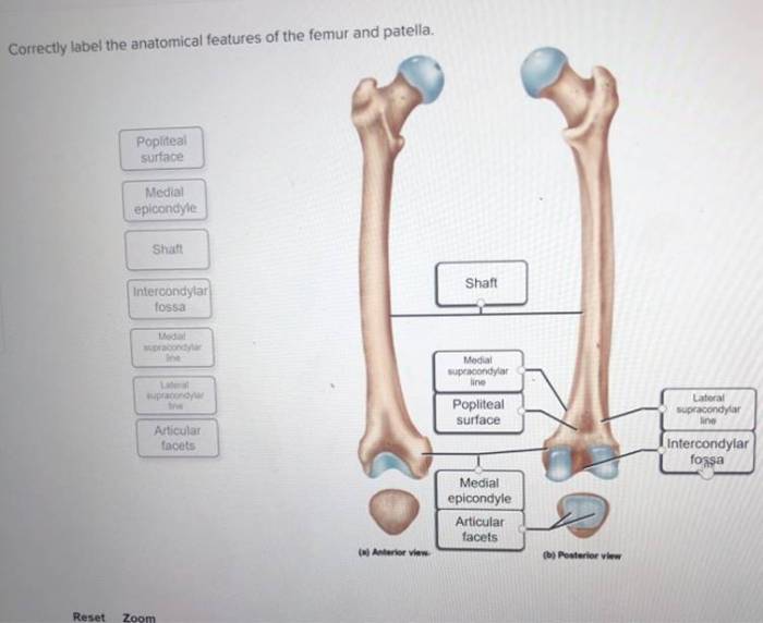 Correctly label the anatomical features of the humerus.