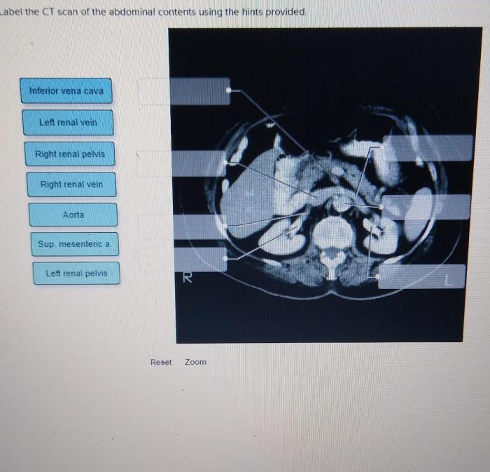 Label the midsagittal male pelvis using the hints provided